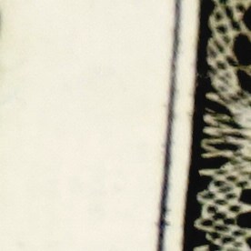 Medicare Parte B aumentará de precio en 2026