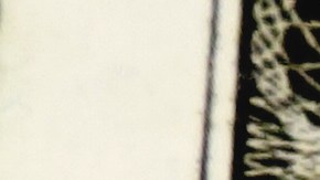 Medicare Parte B aumentará de precio en 2026