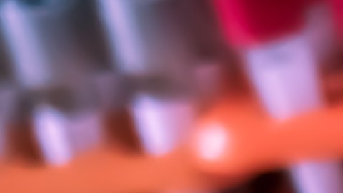 Instan a países europeos a actualizar sus estrategias sobre infecciones de transmisión sexual: son obsoletas