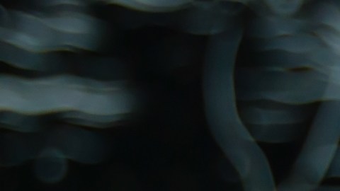 Encías en mal estado pueden ser indicio de problemas cardíacos