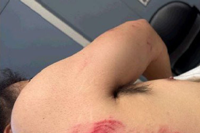 Wilmer Toledo Martínez, inmigrante detenido por ICE