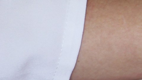 Brote de sarampión en Carolina del Sur ya supera al de Texas, llega a casi 800 casos