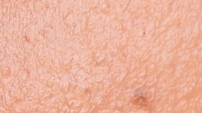 Dermaplaning, un procedimiento estético-facial que se ha hecho viral y no es recomendable