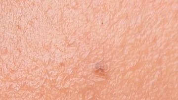 Dermaplaning, un procedimiento estético-facial que se ha hecho viral y no es recomendable