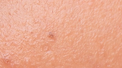 Dermaplaning, un procedimiento estético-facial que se ha hecho viral y no es recomendable