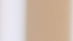 Kaden Rummler, who was injured after being hit with a projectile fired by a federal agent during a protest outside an immigration building in Santa Ana, Calif., poses for a portrait Wednesday, Jan. 14, 2026, in Southern California. (AP Photo/Damian Dovarganes)