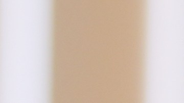 Kaden Rummler, who was injured after being hit with a projectile fired by a federal agent during a protest outside an immigration building in Santa Ana, Calif., poses for a portrait Wednesday, Jan. 14, 2026, in Southern California. (AP Photo/Damian Dovarganes)