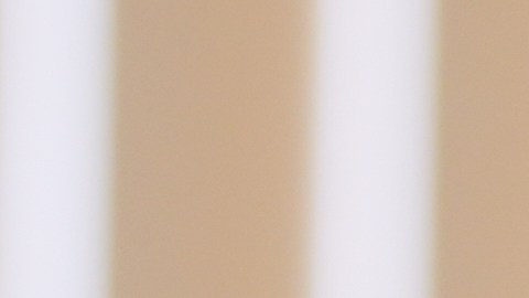 Kaden Rummler, who was injured after being hit with a projectile fired by a federal agent during a protest outside an immigration building in Santa Ana, Calif., poses for a portrait Wednesday, Jan. 14, 2026, in Southern California. (AP Photo/Damian Dovarganes)