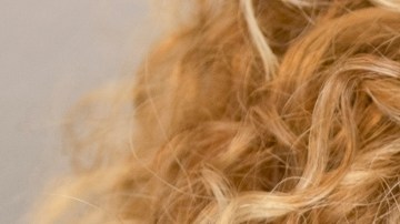 ¿Padeces migraña?: conoce más acerca de este dolor de cabeza intenso y discapacitante