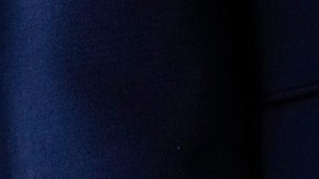 Así lucía la mano derecha de Donald Trump en febrero del año pasado.