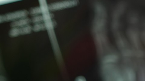 Osteomielitis, una infección grave causada por una bacteria: ¿cómo se trata?