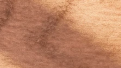 En aras de más privacidad: pruebas de enfermedades de transmisión sexual en el hogar ofrecen nuevas opciones