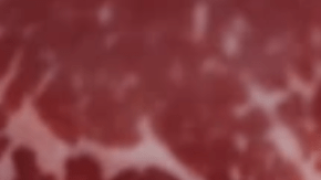 Duplicar la ingesta de proteínas: puede ser peor el remedio que la enfermedad, advierten expertos