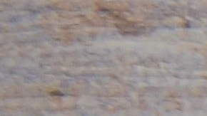 facturas médicas impagables