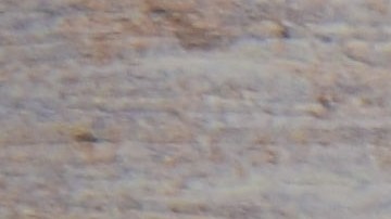 facturas médicas impagables