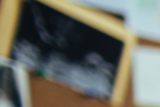 fatiga digital en el trabajo