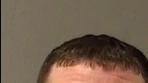 La niña sobrevivió, pero perdió prácticamente toda la visión y sufrió un daño cerebral severo.