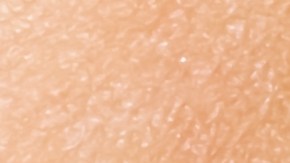 Morder inadecuadamente puede hacerte perder los dientes