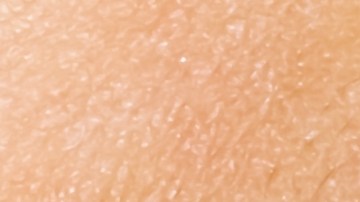 Morder inadecuadamente puede hacerte perder los dientes