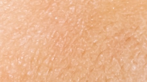 Morder inadecuadamente puede hacerte perder los dientes