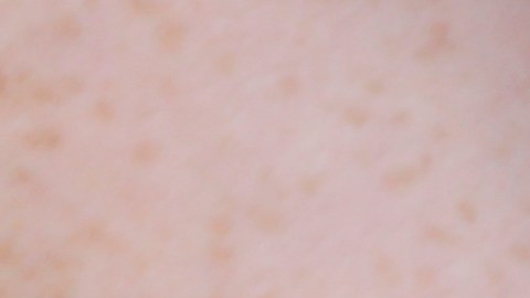 In this Friday, July 21, 2017 photo, a woman is handcuffed after being searched by police for suspected drug paraphernalia at a city park in Delray Beach, Fla. As drug addiction destroys families across America, “there’s a need for a positive, vibrant recovery network to help people get off of opioids,” said State Attorney Dave Aronberg, chief prosecutor in Palm Beach County. “You can’t just arrest your way out of this problem.” But lately, South Florida has become the focal point of rampant insurance fraud that relies on a lethal cycle of failure, authorities say. (AP Photo/Lynne Sladky)