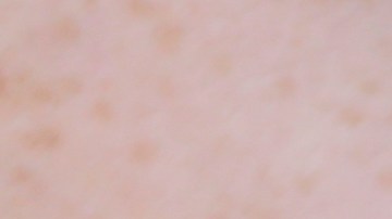 In this Friday, July 21, 2017 photo, a woman is handcuffed after being searched by police for suspected drug paraphernalia at a city park in Delray Beach, Fla. As drug addiction destroys families across America, “there’s a need for a positive, vibrant recovery network to help people get off of opioids,” said State Attorney Dave Aronberg, chief prosecutor in Palm Beach County. “You can’t just arrest your way out of this problem.” But lately, South Florida has become the focal point of rampant insurance fraud that relies on a lethal cycle of failure, authorities say. (AP Photo/Lynne Sladky)