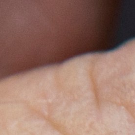 In this Thursday, Jan. 29, 2015 photo, pediatrician Charles Goodman holds a dose of the measles-mumps-rubella, or MMR, vaccine at his practice in Northridge, Calif. The vaccine is 99 percent effective at preventing measles, which spreads easily through the air and in enclosed spaces. Symptoms include fever, runny nose, cough and a rash all over the body. (AP Photo/Damian Dovarganes)