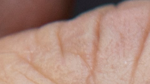 In this Thursday, Jan. 29, 2015 photo, pediatrician Charles Goodman holds a dose of the measles-mumps-rubella, or MMR, vaccine at his practice in Northridge, Calif. The vaccine is 99 percent effective at preventing measles, which spreads easily through the air and in enclosed spaces. Symptoms include fever, runny nose, cough and a rash all over the body. (AP Photo/Damian Dovarganes)