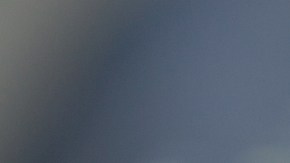 Virus que afectan más tu estómago: estos son los gérmenes que debes evitar