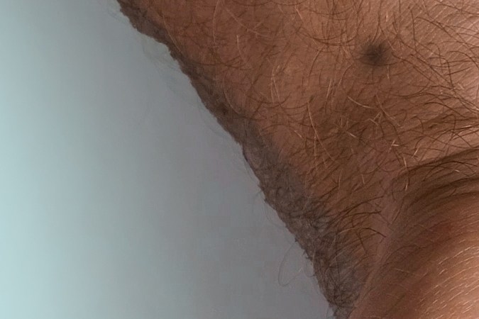 Brote de sarampión en centro de detención de ICE.