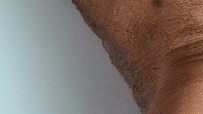 Brote de sarampión en centro de detención de ICE.