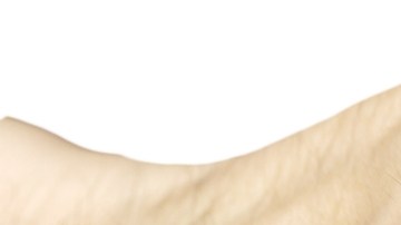 ¿Puedo evitar efectivamente la caída del cabello? Avances terapéuticos contra la alopecia en hombres y mujeres