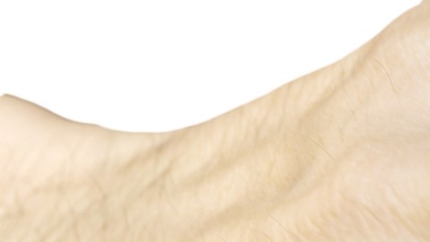 ¿Puedo evitar efectivamente la caída del cabello? Avances terapéuticos contra la alopecia en hombres y mujeres