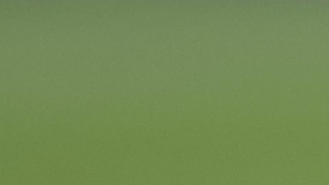 San Diego, California, Estados Unidos, 11 de marzo de 2026. Marcel Ruiz resultó lesionado, durante el partido de ida de los Octavos de Final de la Champions Cup de la CONCACAF 2026, entre el San Diego FC y los Diablos Rojos del Toluca, realizado en el Snapdragon Stadium. Foto: Imago7/ Rafael Vadillo