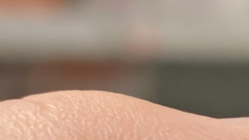 FDA actualizó etiqueta de la leucovorina: la aprueba para enfermedad genética rara, no para el autismo