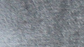 In this Monday, Sept. 23, 2013 photo, Belky Rubio shows her ankle monitor in Homestead, Fla. Rubio, who is an undocumented immigrant in the process of being deported, must wear the monitor to allow authorities to keep track of her 24 hours a day instead of being held at an immigration detention center. (AP Photo/Wilfredo Lee)