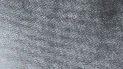 In this Monday, Sept. 23, 2013 photo, Belky Rubio shows her ankle monitor in Homestead, Fla. Rubio, who is an undocumented immigrant in the process of being deported, must wear the monitor to allow authorities to keep track of her 24 hours a day instead of being held at an immigration detention center. (AP Photo/Wilfredo Lee)