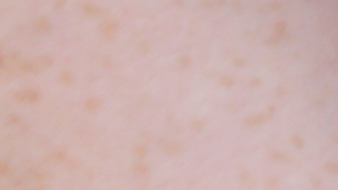 In this Friday, July 21, 2017 photo, a woman is handcuffed after being searched by police for suspected drug paraphernalia at a city park in Delray Beach, Fla. As drug addiction destroys families across America, “there’s a need for a positive, vibrant recovery network to help people get off of opioids,” said State Attorney Dave Aronberg, chief prosecutor in Palm Beach County. “You can’t just arrest your way out of this problem.” But lately, South Florida has become the focal point of rampant insurance fraud that relies on a lethal cycle of failure, authorities say. (AP Photo/Lynne Sladky)