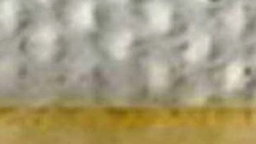 Innovadora alternativa para el tratamiento de la hipertensión crean en México: un parche dérmico