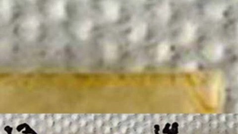 Innovadora alternativa para el tratamiento de la hipertensión crean en México: un parche dérmico