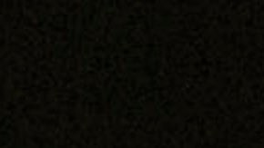 Canelo Álvarez se siente en óptimas condiciones tras su cirugía