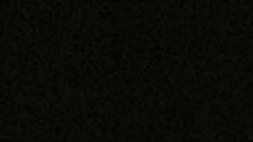 Canelo Álvarez se siente en óptimas condiciones tras su cirugía