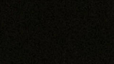 Canelo Álvarez se siente en óptimas condiciones tras su cirugía