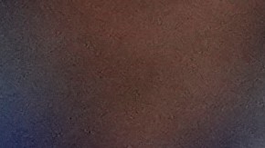 Toronto Blue Jays' Alejandro Kirk leaves game after getting hit by a pitch against the Los Angeles Dodgers during the ninth inning in Game 6 of baseball's World Series, Friday, Oct. 31, 2025, in Toronto. (AP Photo/Brynn Anderson)