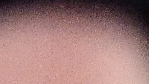 Luka Doncic sufrió la lesión del tendón de la corva durante el tercer periodo de un partido entre los Lakers y OKlahoma City que el equipo del Thunder ganaba por 32 puntos.