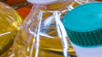 Identifica los alimentos que te causan inflamación