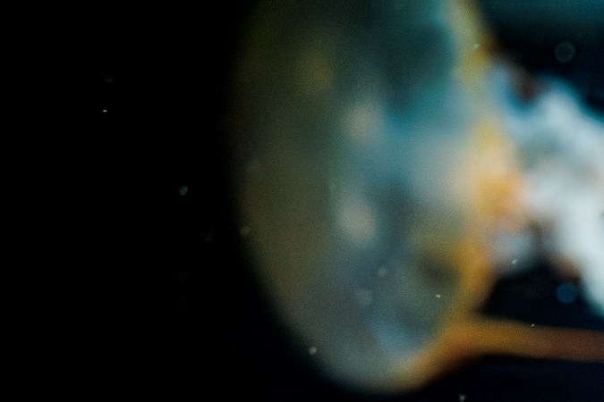 La picadura más dolorosa del mundo: seguro preferirás que te golpee Mike Tyson o que te apliquen un martillo neumático en los riñones