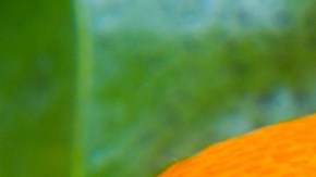 El consumo diario de naranja puede modificar el perfil lipídico de los pacientes con hígado graso
