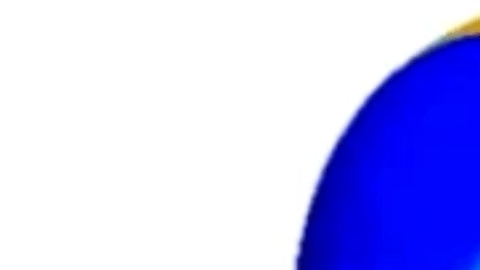 Médicos probaron "gemelo digital" para corregir el ritmo cardíaco irregular de un paciente