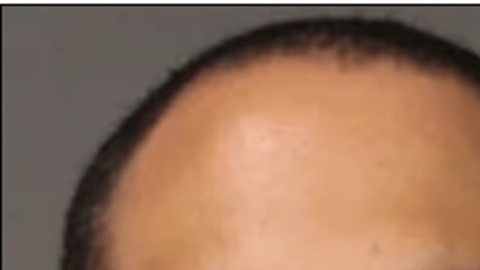 Los acusados fueron identificados como Kevin Canaan, de 28 años, y Yennifer Tavarez-Cepeda, de 25